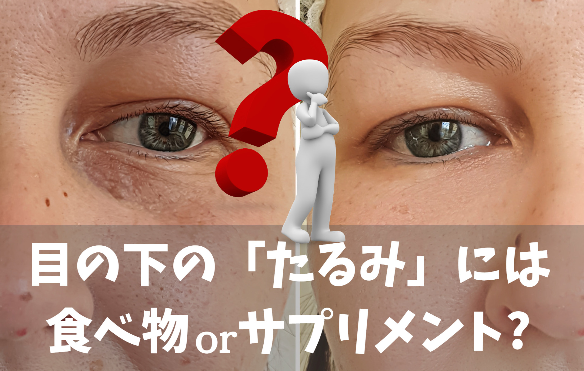 目の下のたるみに効く食べ物よりもサプリメントを利用すべき3つの理由!日本で唯一顔肌のうるおい効果が実証されているサプリとは?